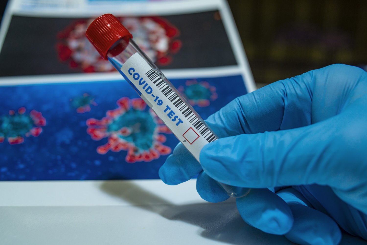 Eine Person hat im Main-Kinizig-Kreis hat sich mit dem Virus infiziert.