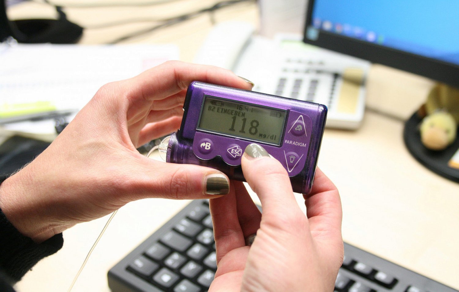 Augen auf die Stoffwechselkrankheit: Eine Typ-1-Diabetikerin und Insulinpumpenträgerin hat KINZIG.NEWS ihre ganz persönliche Geschichte erzählt.