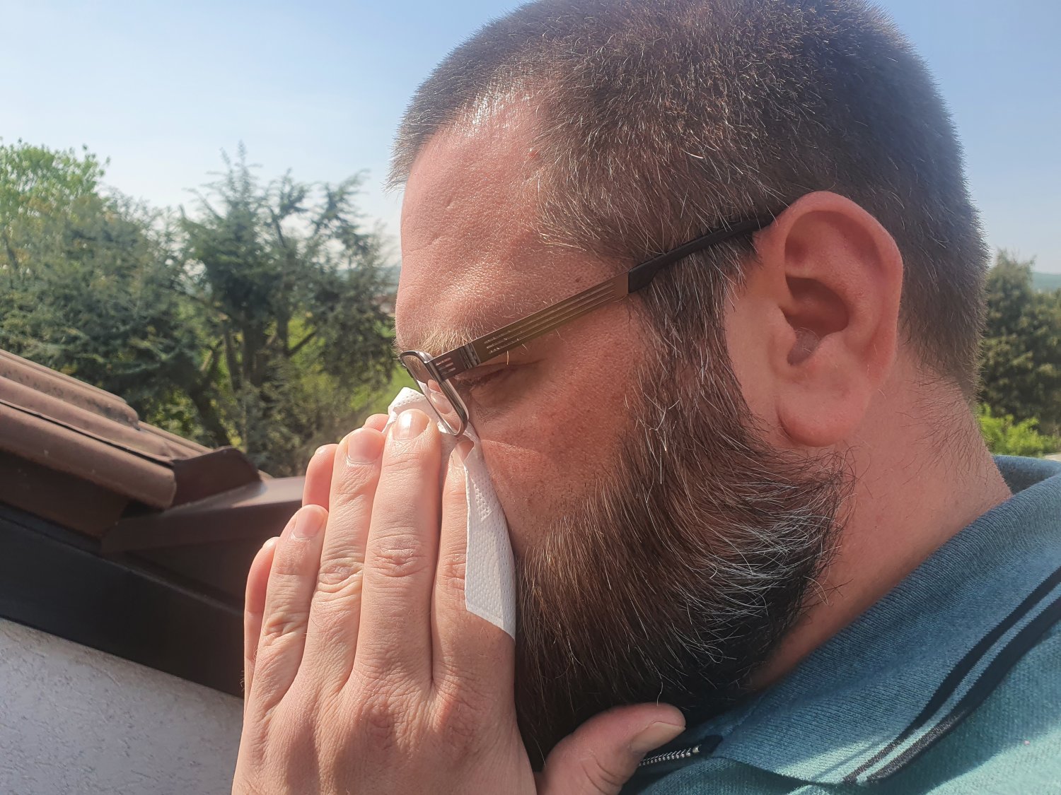 Achtung, starker Pollenflug: Allergiker trifft es aktuell besonders heftig
